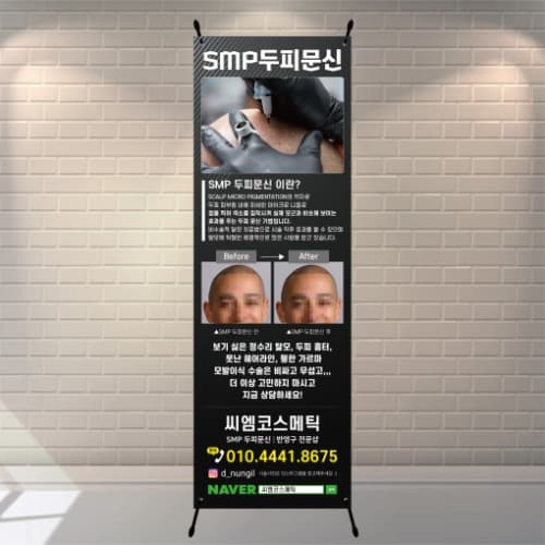 SMP 두피문신 입간판